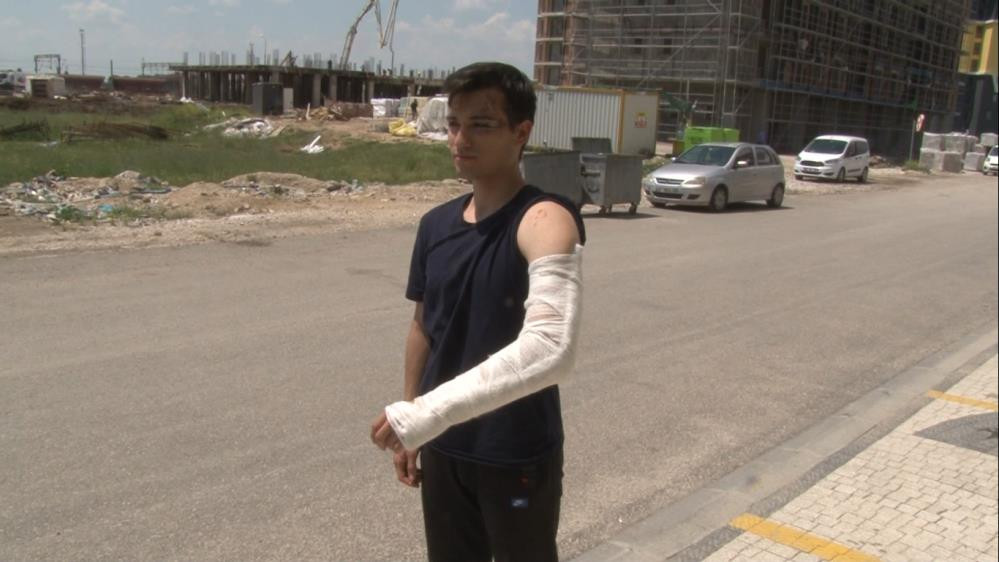 Üniversiteli gence sokak köpekleri 10'uncu kez saldırdı - Resim : 2