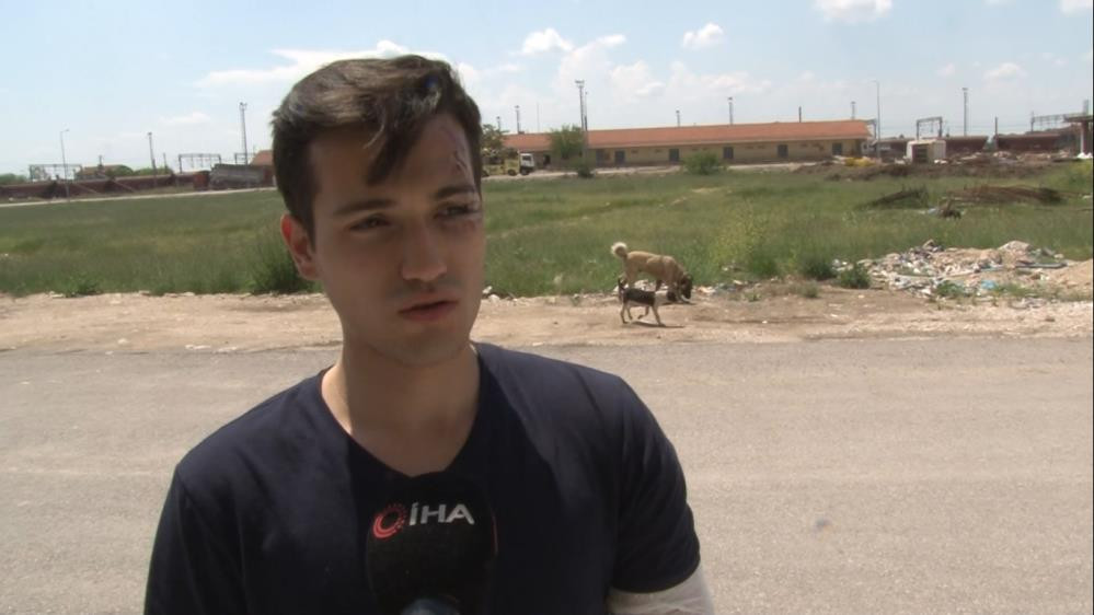 Üniversiteli gence sokak köpekleri 10'uncu kez saldırdı - Resim : 4