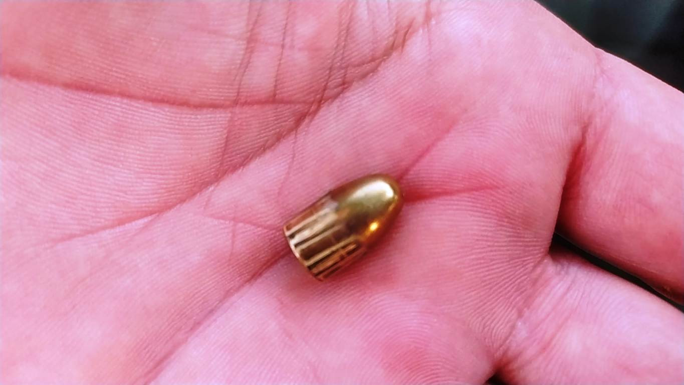 Evinin bahçesinde otururken göğsüne mermi saplandı - Resim : 2