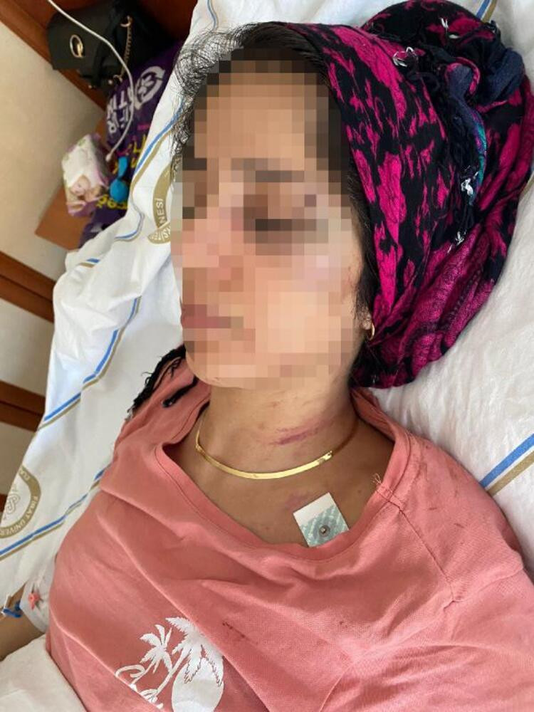 Doktor da bunu yaparsa! Sevgilisini dövüp 5 yerinden bıçakladı… - Resim : 3