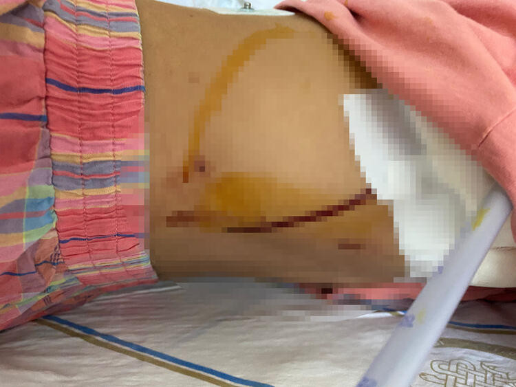 Doktor da bunu yaparsa! Sevgilisini dövüp 5 yerinden bıçakladı… - Resim : 4