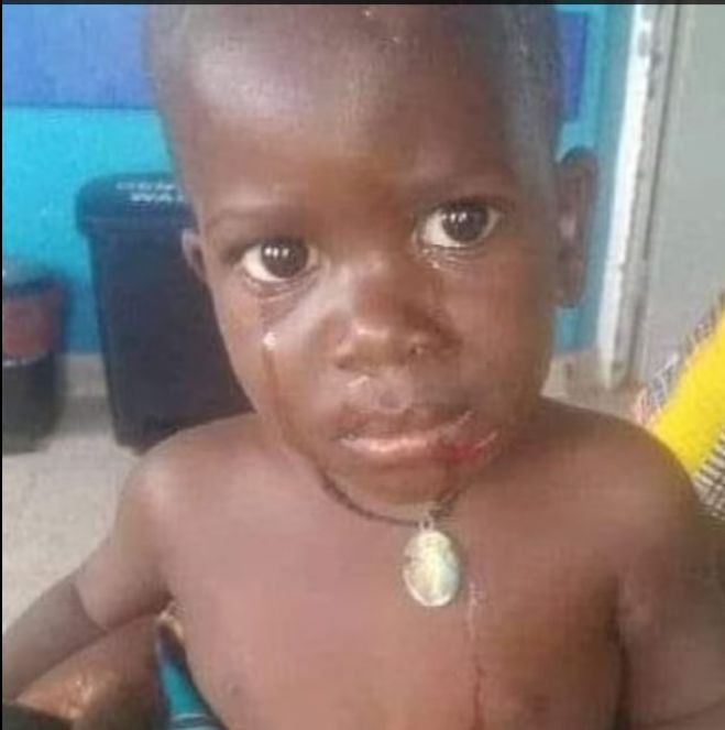 Su aygırı yuttuğu çocuğu taş atılınca kustu - Resim : 2