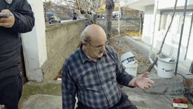 Aracının LPG tankı öldürüyordu - Resim : 6