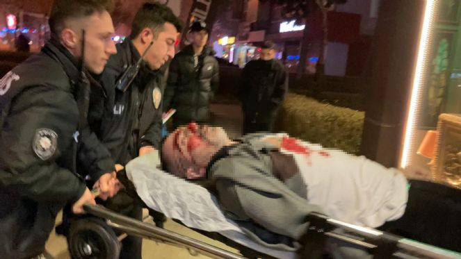 Emanet verdiği silah ateş aldı, kuzeni göğsünden vuruldu - Resim : 1