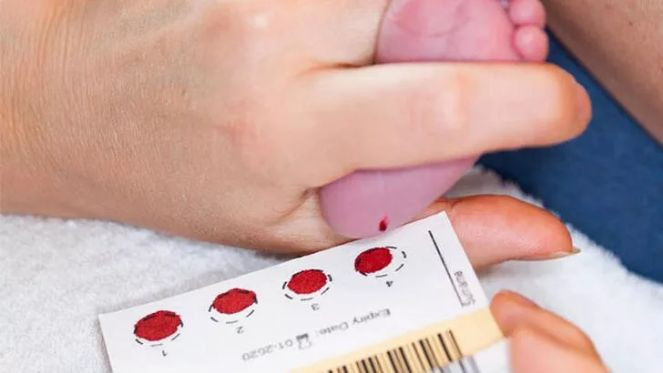 “Yerim ben o ayağı!” diyeceğinize bu testi yaptırın - Resim : 3