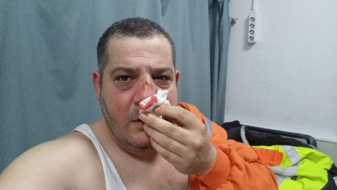 İşitme engelliye eşime baktın dayağı - Resim : 1