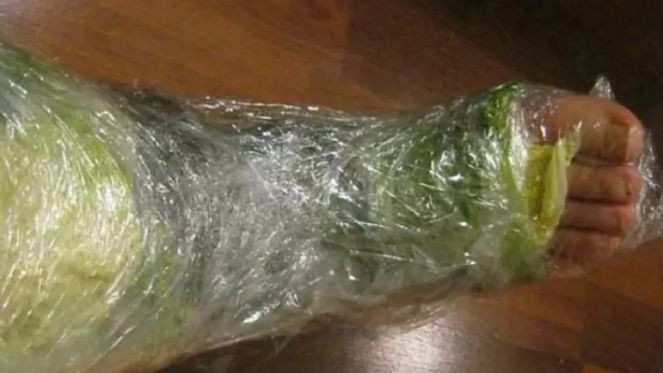 Lahana yapraklarının mucize faydası ortaya çıktı. 1 saat içinde yok ediyor - Resim : 1