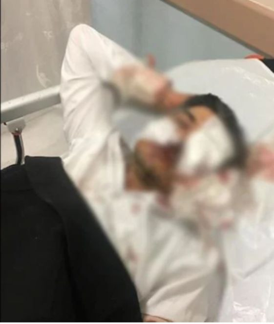 Sivas Ziraat Odası Genel Sekreteri saldırıda ağır yaralandı - Resim : 1