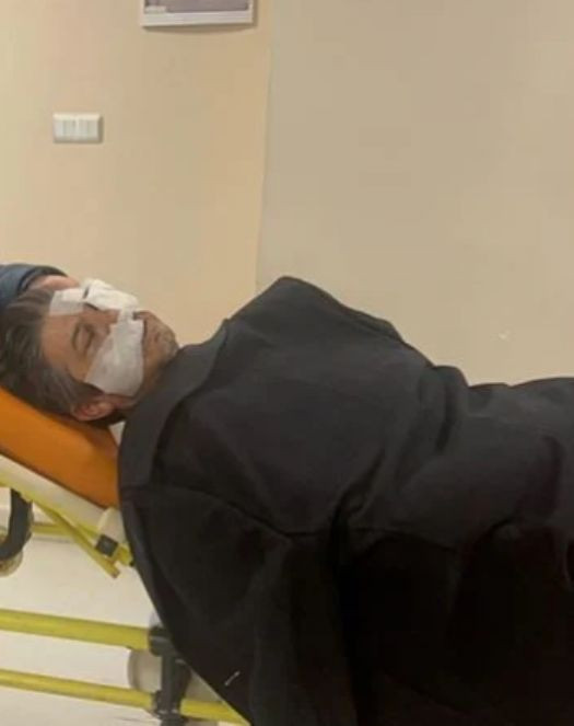 Sivas Ziraat Odası Genel Sekreteri saldırıda ağır yaralandı - Resim : 2