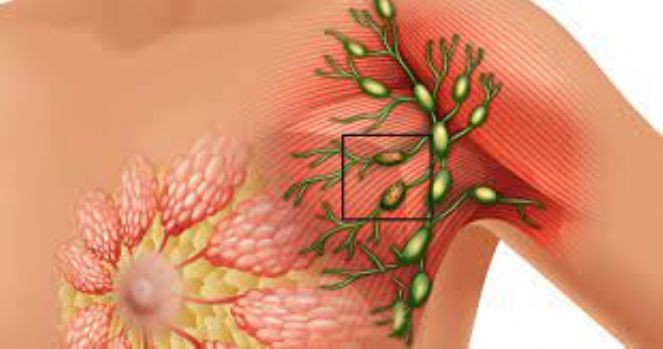 Meme kanserinin erken belirtisini çok önemli - Resim : 3