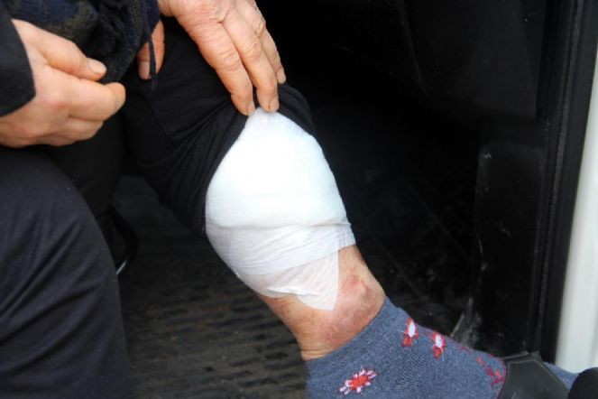 Kadının patlayan varisi polisleri alarma geçirdi - Resim : 5