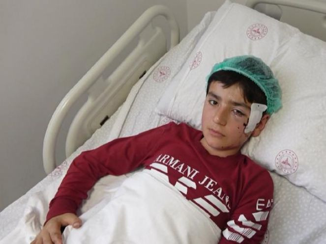 Aksaray'da pitbull vahşeti. Koyun otlatırken saldırıya uğradı - Resim : 2