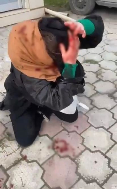 Barışmayan dini nikahlı karısına dehşeti yaşattı - Resim : 6