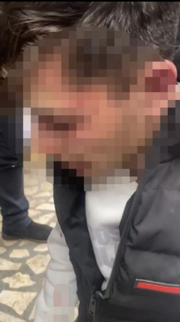 Zehir tacirlerini mahalleli dövdü - Resim : 2