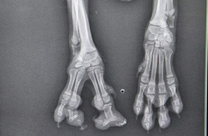 'Kahve'nin yapışık parmakları operasyonla ayrıldı - Resim : 6