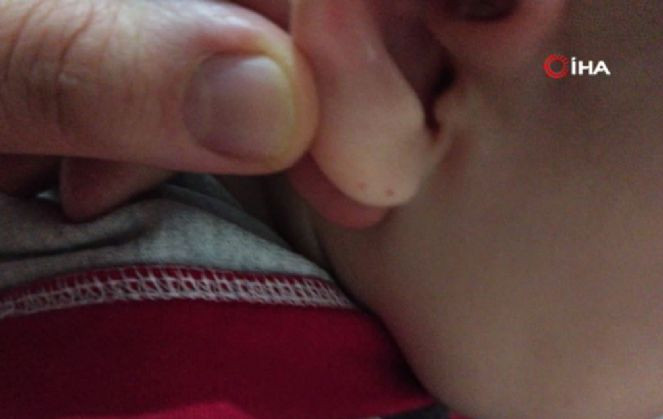 Iğdırlı aile perdenin üzerinde gördü şok üstüne şok yaşadı. Çocukları ağlayınca odaya koştular - Resim : 1