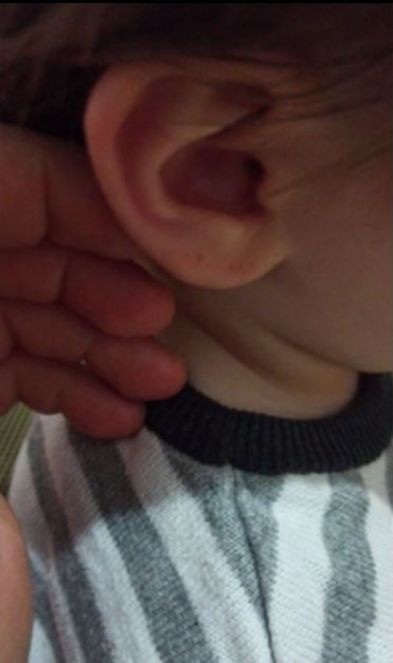 Iğdırlı aile perdenin üzerinde gördü şok üstüne şok yaşadı. Çocukları ağlayınca odaya koştular - Resim : 2