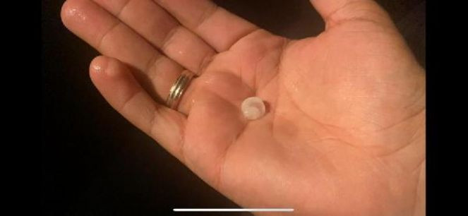 Hatay'ı dolu vurdu şimşekler geceyi aydınlattı - Resim : 5