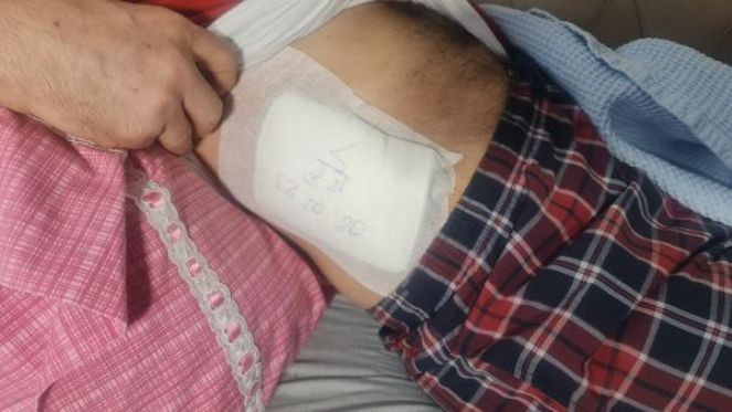 Genç kızı taciz eden yabancı uyruklu kişiye tepki gösterdi, bıçaklandı - Resim : 3