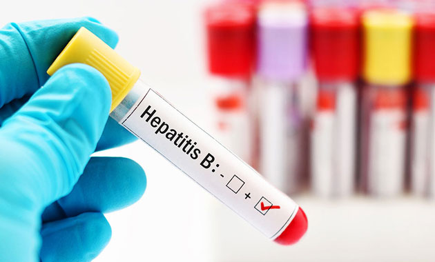 Her 3 kişiden biri Hepatit B virüsü ile karşı karşıya
