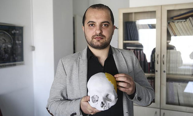 Türkiye'de bir ilk: Parçalanan kafatasına üç boyutlu tedavi