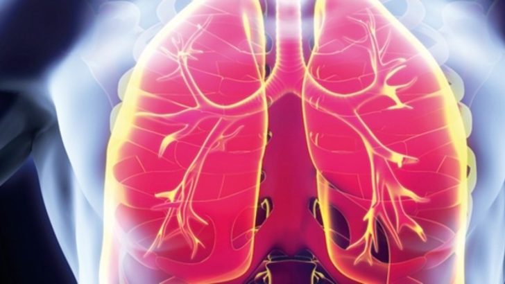 Akciğer sönmesi nedir, neden olur, tedavisi var mı? (Pnömotoraks)