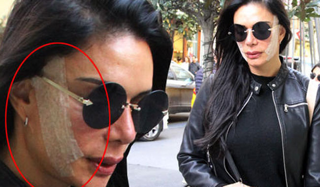 Sevda Demirel Kim Kardashian'a benzemek için ameliyat oldu