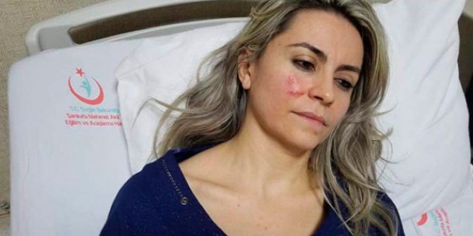 Şanlıurfa'da kadın doktor saldırıya uğradı!