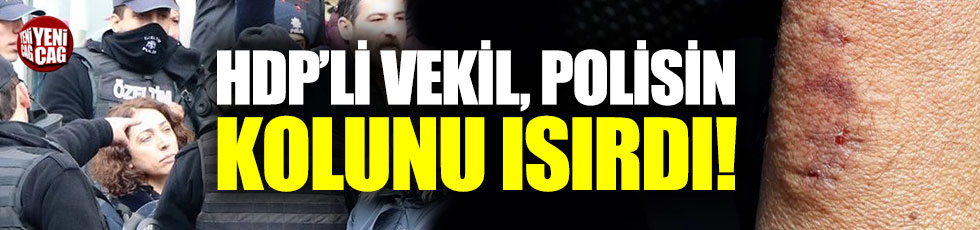 HDP'li vekil polisin kolunu ısırdı