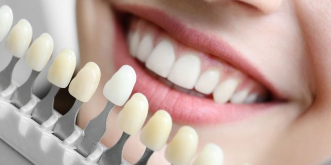 Dişlerdeki renk değişimi hangi sebeplere bağlı?
