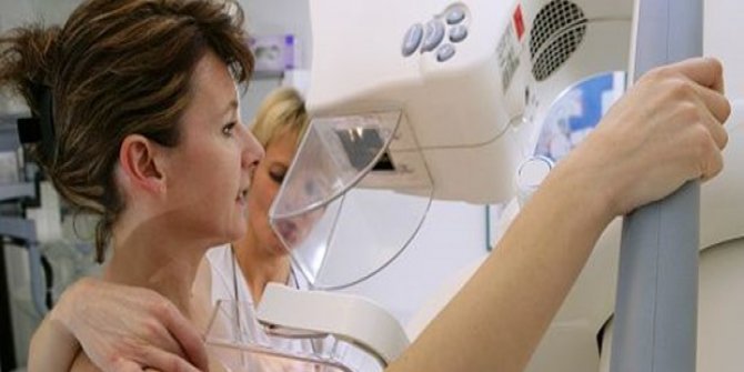 2 milyon 500 bin kadına meme kanseri taraması