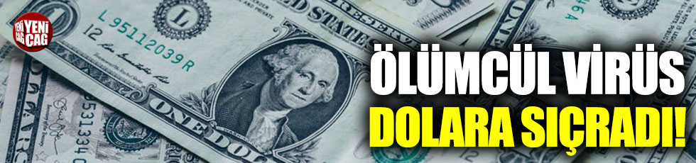 Dolar virüs kaptı!