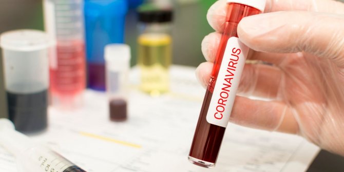 Barış Yarkadaş: Coronavirüsünü araştırmayı engellemek...