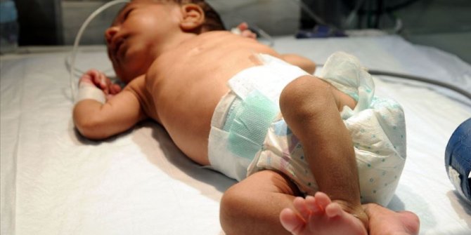 "Türkiye'de her yıl 15 bin bebek kalp hastalığıyla doğuyor"