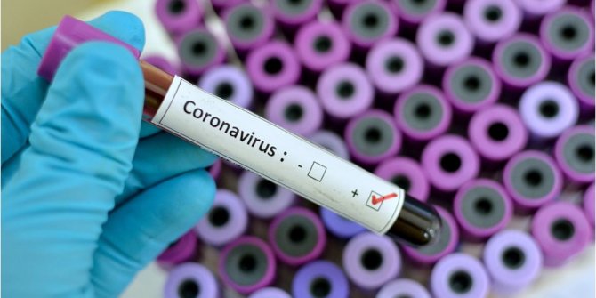 Güney Kore'de coronavirüs kaynaklı ilk ölüm
