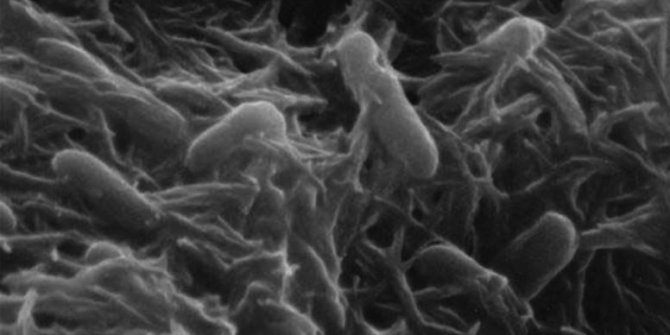 Taş soluyan bakteriler kuantum bilgisayarlara katkı sağlayabilir mi?