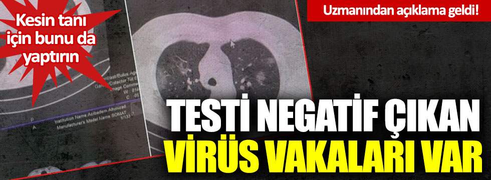 Salih Cenap Çevli: “Testi negatif çıkan Korona virüs hastaları var”