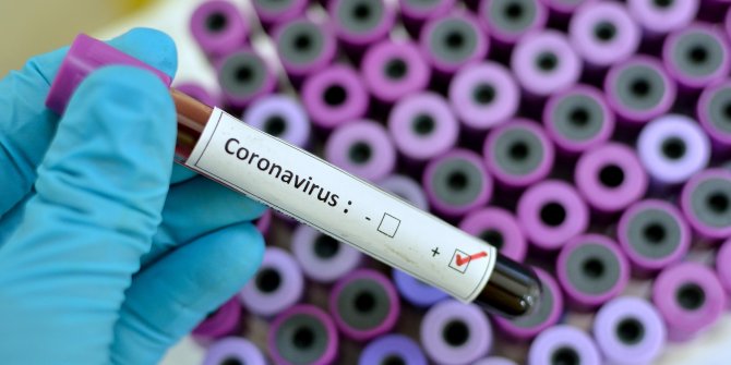 Korona virüsü kalıcı olarak yok eden ürün geliştirildi