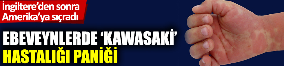 Ebeveynlerde 'kawasaki' hastalığı paniği