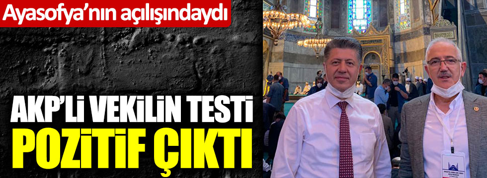 Son dakika: AKP'li İsmail Bilen'in korona virüs testi pozitif çıktı