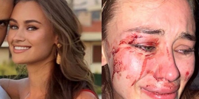 Top modele saldırıyı Bakan Ersoy kınadı