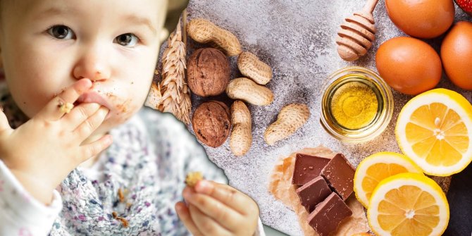 Bebeklerde veya çocuklarda besin alerjisine sebep olan gıdalar