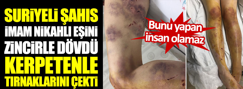 Bunu yapan insan olamaz! Suriyeli şahıs, imam nikahlı eşini zincirle dövdü, kerpetenle tırnaklarını çekti