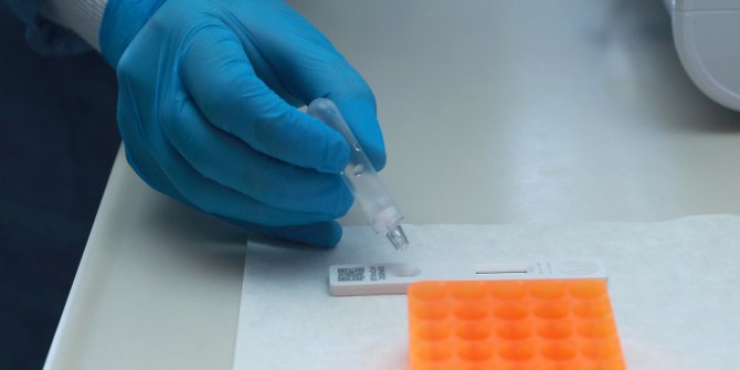 Sağlık Bakanlığı'ndan korona virüs test kiti satışı yapan sitelere erişim engeli