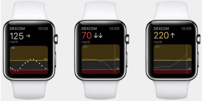 Apple Watch Series 7 Kan Şekeri ölçebilecek