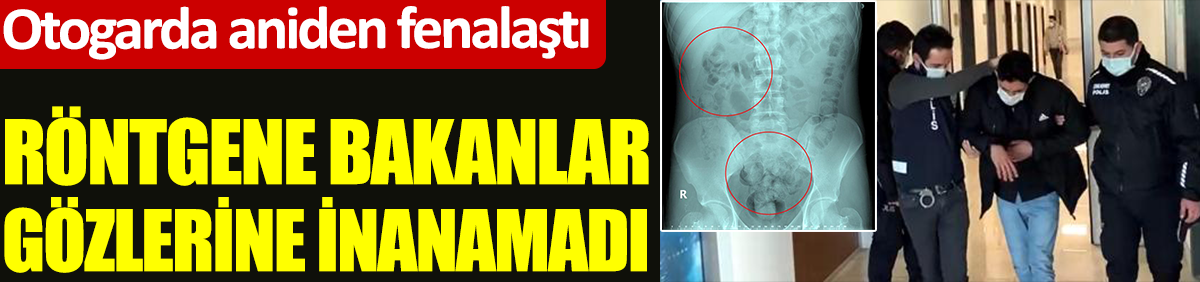 Ankara'da röntgene bakanlar gözlerine inanamadı. Otogarda aniden fenalaştı