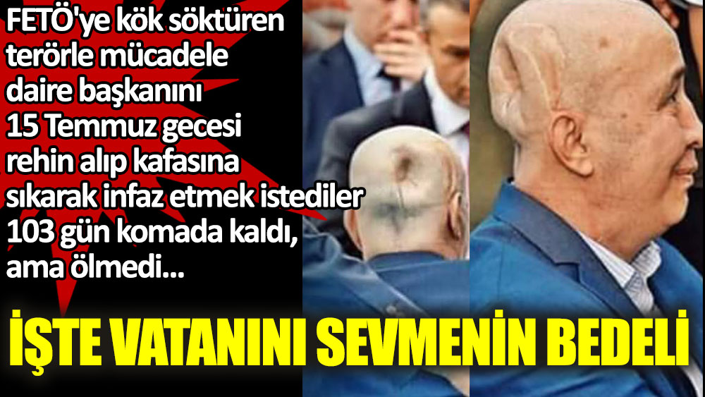 FETÖ'ye kök söktüren Emniyet Müdürü Turgut Aslan'ı 15 Temmuz'da böyle infaz etmek istemişlerdi. İşte Vatanını sevmenin bedeli!