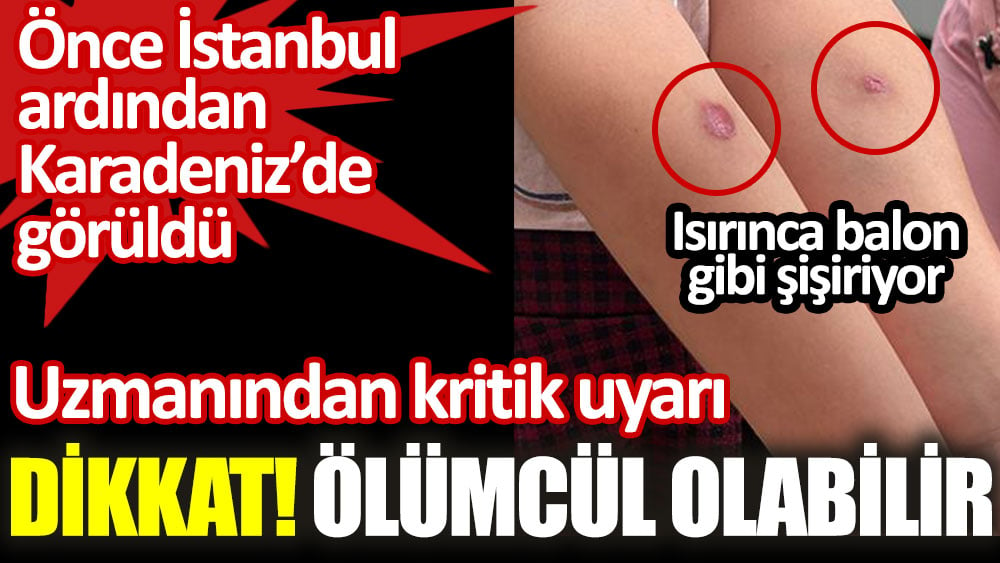 Uzmanından kritik Asya Kaplan Sivrisineği uyarısı. Dikkat ölümcül olabilir