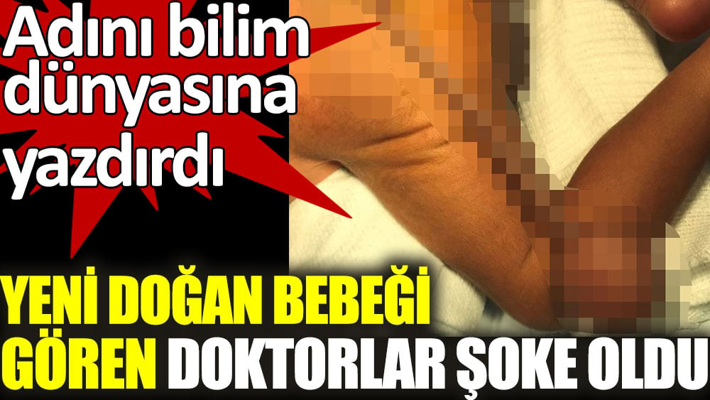 Yeni doğan bebeği görenler şoke oldu. Adını bilim dünyasına yazdırdı