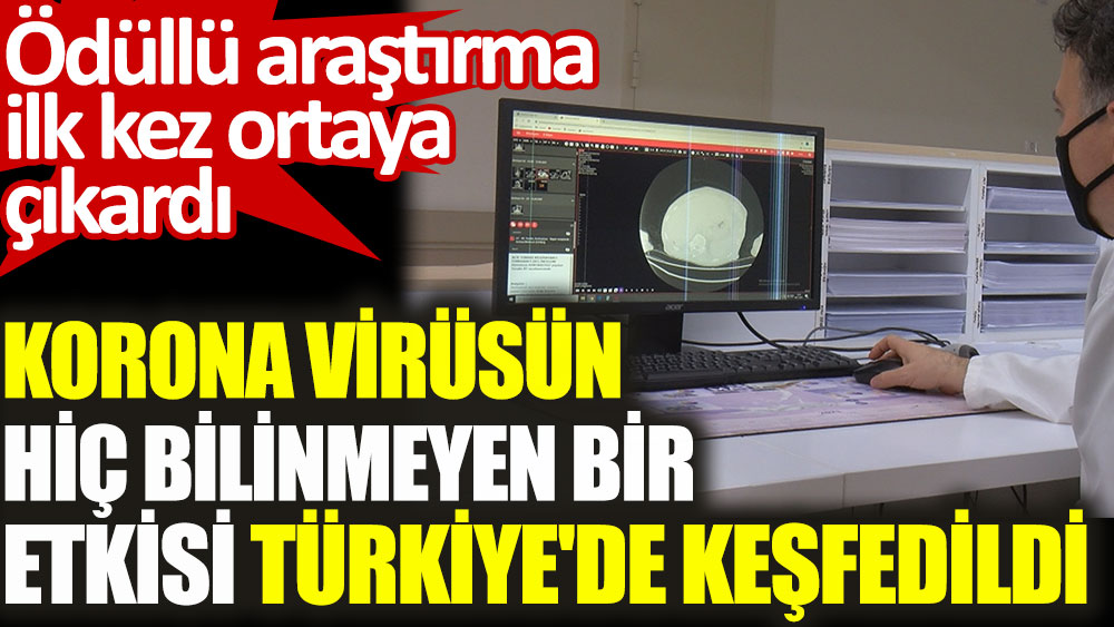 Korona virüsün hiç bilinmeyen bir etkisi Türkiye'de keşfedildi